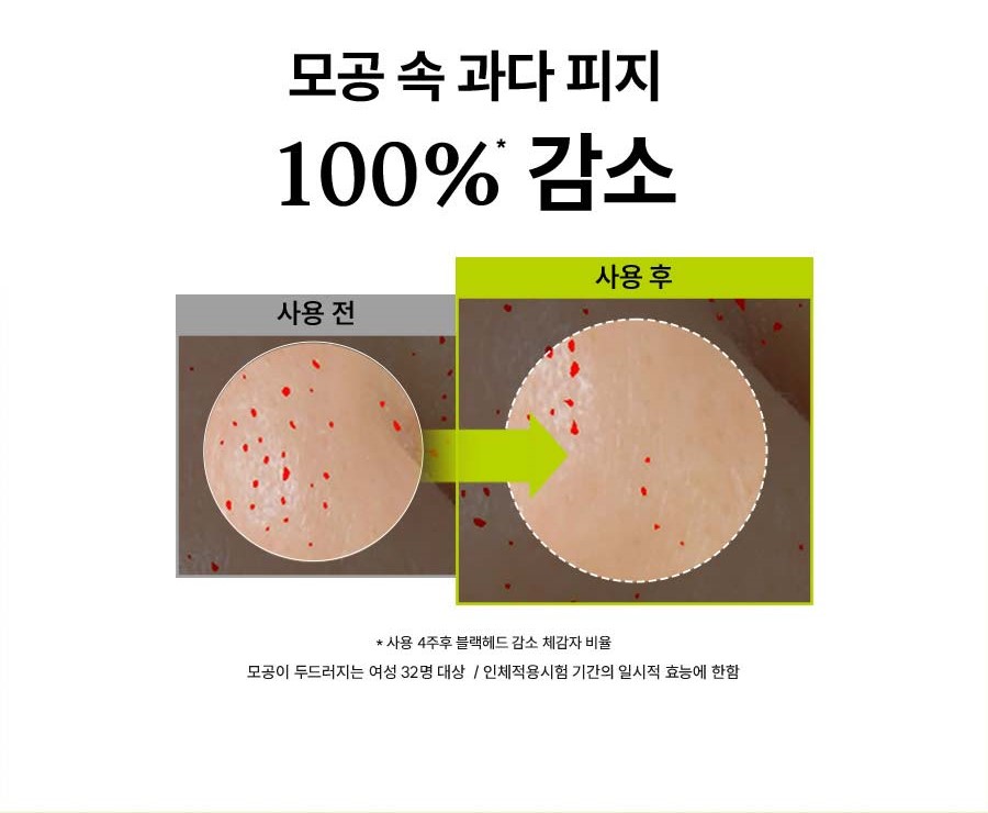 모공 속 과다 피지 100%* 감소